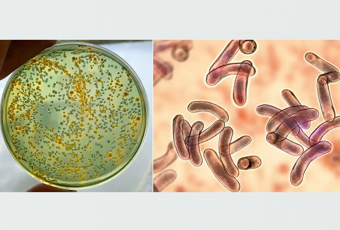 Vibrio Risk